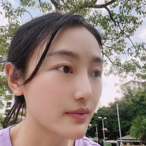 低调的、凤凰的整形术后图片