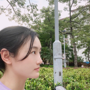 低调的、凤凰的整形术后图片