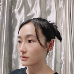 低调的、凤凰的整形术后图片