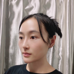 低调的、凤凰的整形术后图片