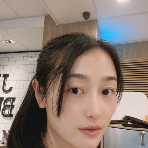 低调的、凤凰的整形术后图片