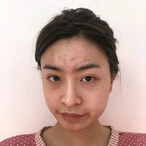 整形前后对比图片