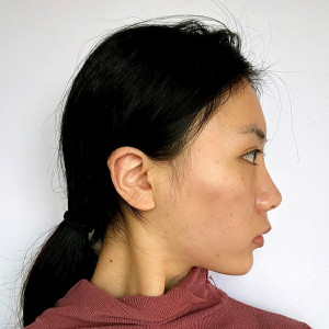 整形前后对比图片