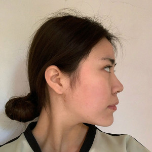 整形前后对比图片