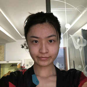 整形前后对比图片