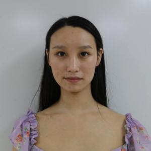 整形前后对比图片