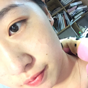 整形前后对比图片