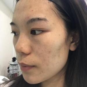 整形前后对比图片