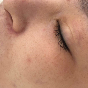 整形前后对比图片