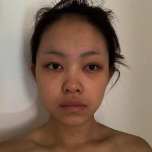 整形前后对比图片