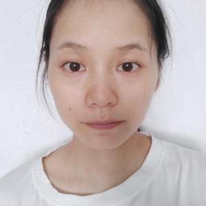 整形前后对比图片