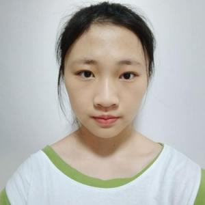 整形前后对比图片