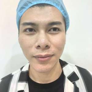 整形前后对比图片