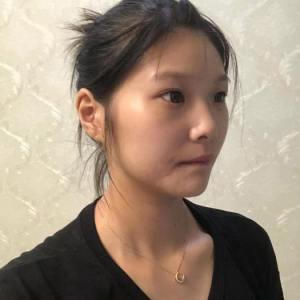 整形前后对比图片