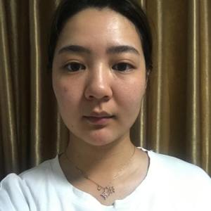 整形前后对比图片