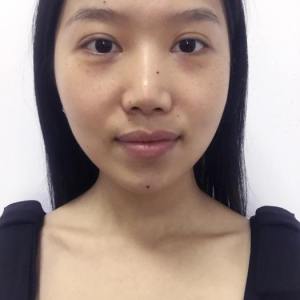 整形前后对比图片