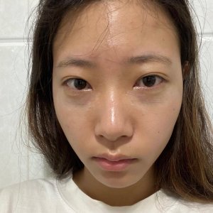 整形前后对比图片