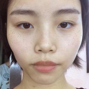 整形前后对比图片