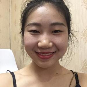 整形前后对比图片