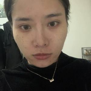 整形前后对比图片