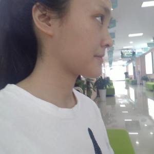 整形前后对比图片