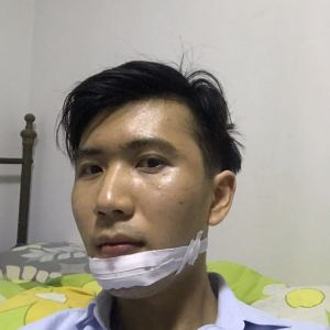 谁说我bu在、的整形术后图片