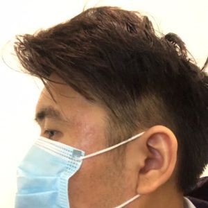 谁说我bu在、的整形术后图片