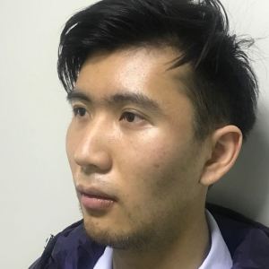 谁说我bu在、的整形术后图片