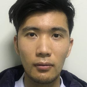 谁说我bu在、的整形术后图片