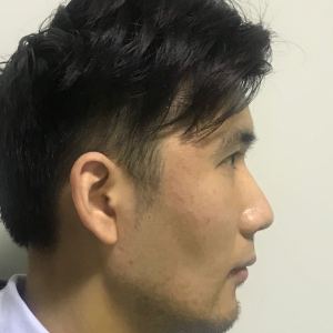 谁说我bu在、的整形术后图片