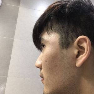 谁说我bu在、的整形术后图片