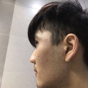 谁说我bu在、的整形术后图片