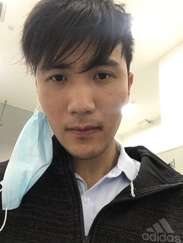 谁说我bu在、的整形术后图片