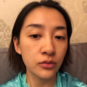 整形前后对比图片