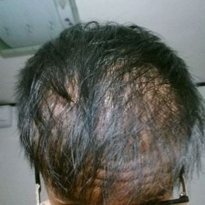 整形前后对比图片