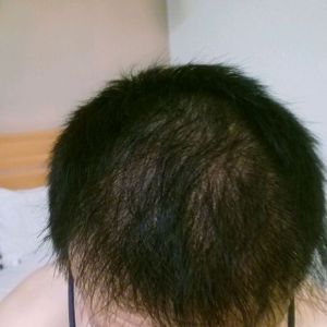 整形前后对比图片