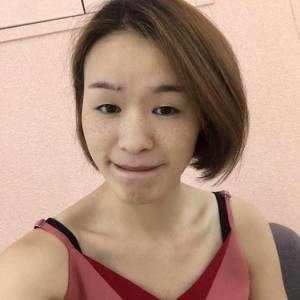 整形前后对比图片