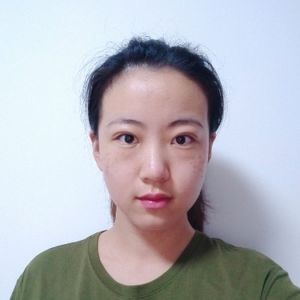 整形前后对比图片