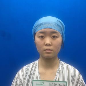 整形前后对比图片