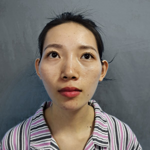 整形前后对比图片