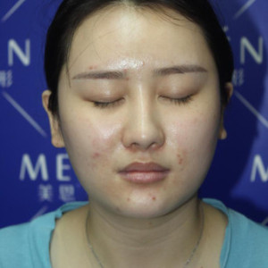 整形前后对比图片