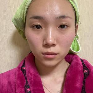 整形前后对比图片