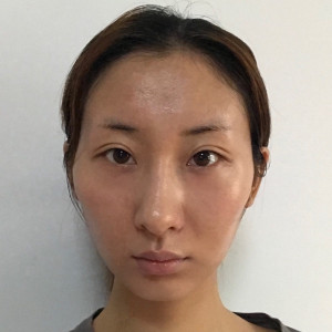 整形前后对比图片