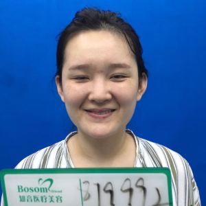 整形前后对比图片