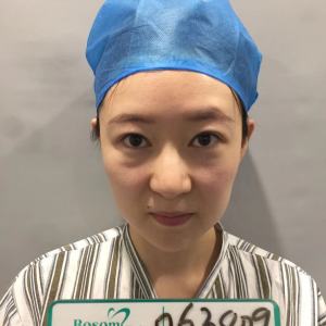 整形前后对比图片