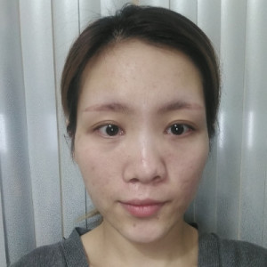 整形前后对比图片