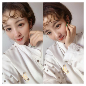 整形前后对比图片