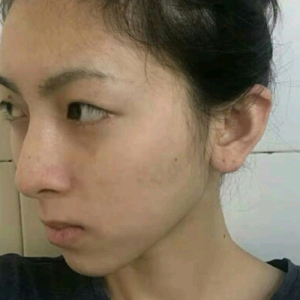 整形前后对比图片