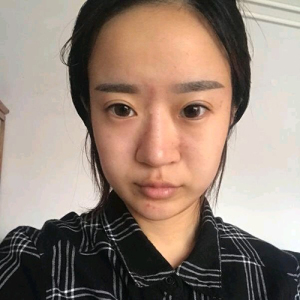 整形前后对比图片