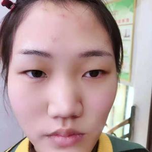 整形前后对比图片